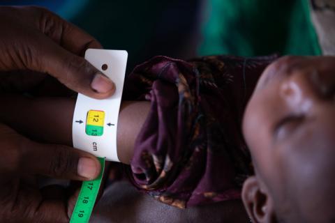 Twelve-month-old Fatun was enrolled in a supplementary feeding programme in Gedo, in southern Somalia, in June 2022. (Samantha Reinders/WFP)